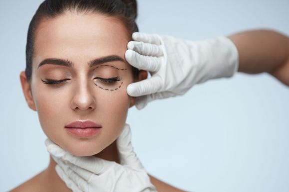 Blépharoplastie médicale au laser