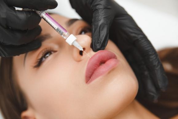 Injection d'acide hyaluronique lèvres